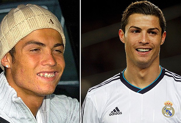 Sonrisa perfecta famosos - Cristiano Ronaldo