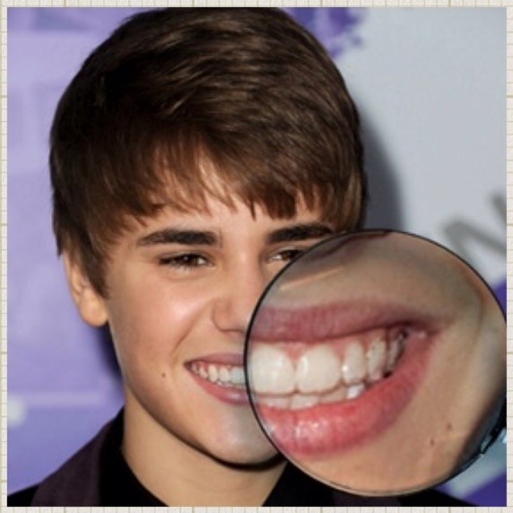Sonrisa perfecta famosos - Justin Bieber