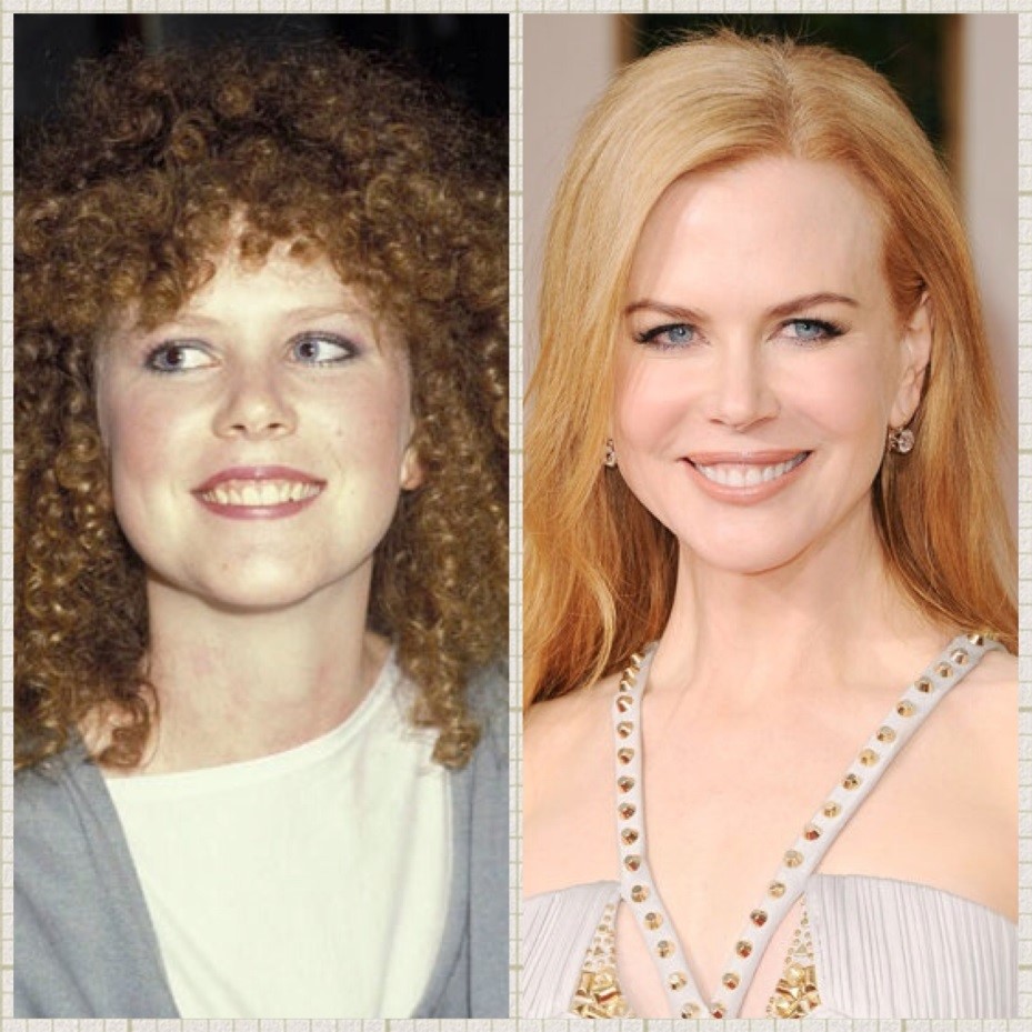 Sonrisa perfecta famosos - Nicole Kidman